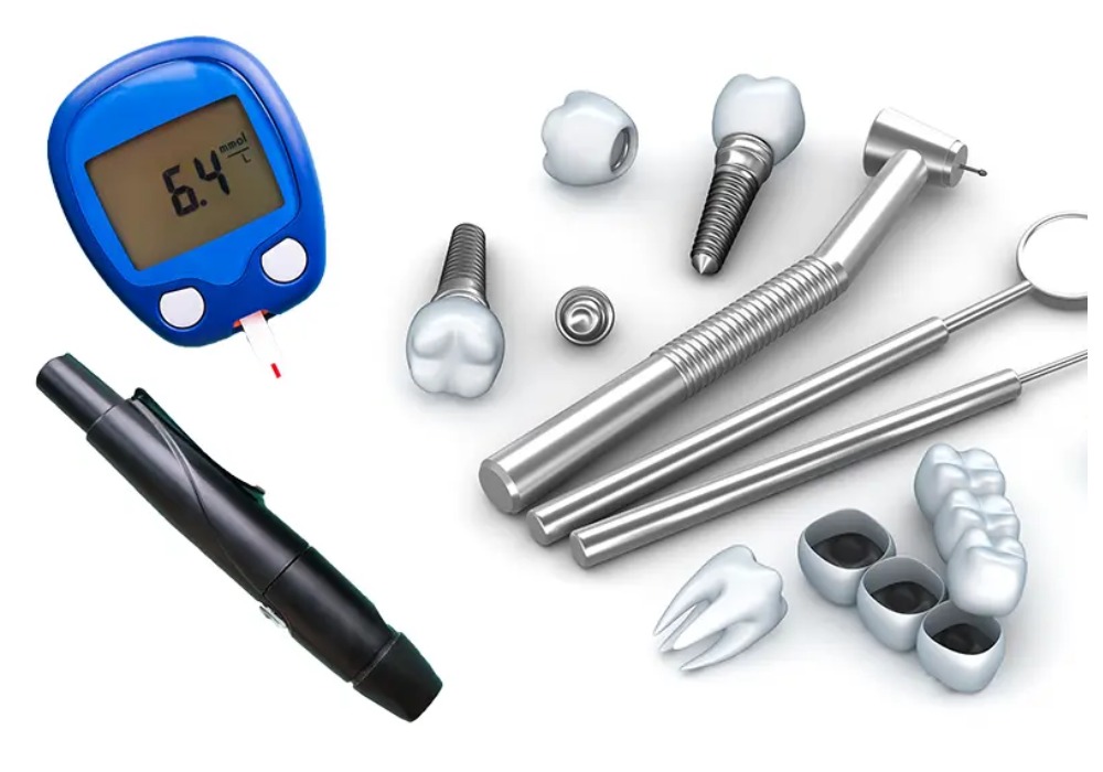 Nha Khoa Quốc Tế Sài Gòn Kiểm soát đường huyết là yếu tố then chốt quyết định sự thành công của ca cấy ghép Implant