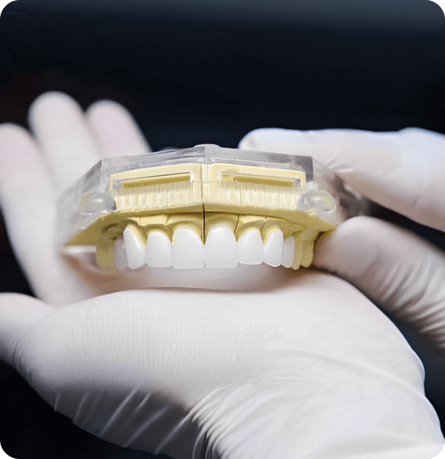 Phục hình răng sứ thẩm mỹ trên trụ Implant toàn hàm