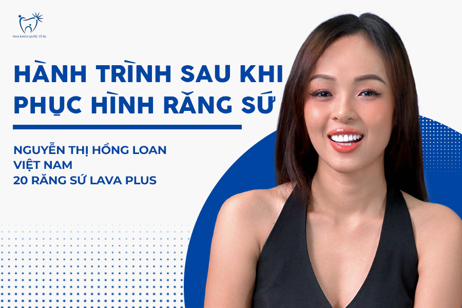 Hành trình phục hình răng sứ thẩm mỹ của chị Loan