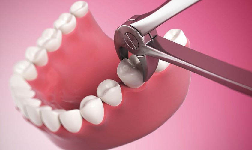 Nha Khoa Quốc Tế Sài Gòn Răng cấm giữ vai trò quan trọng trong việc nhai và ổn định cấu trúc hàm