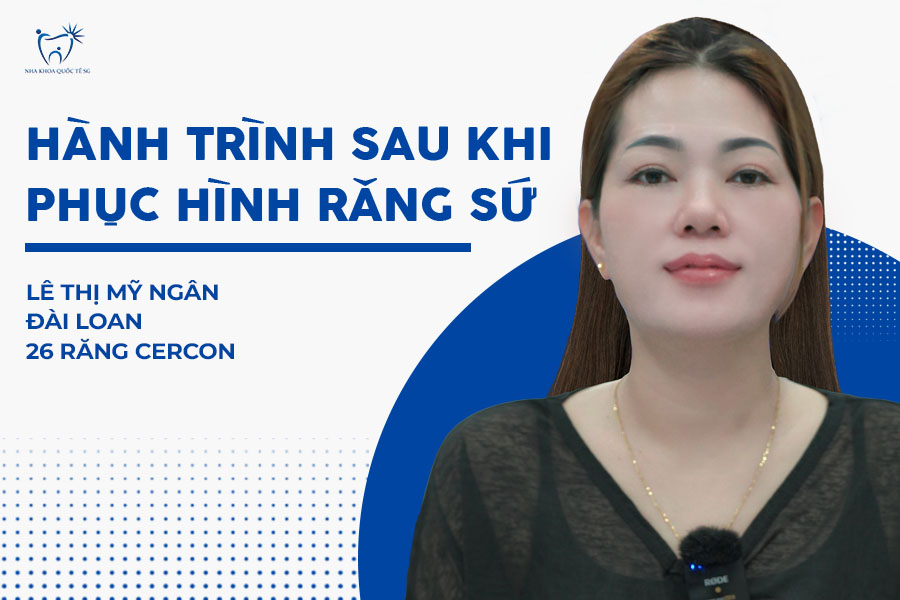 [Review] Hành Trình Bọc 26 Răng Sứ Cercon Của Chị Mỹ Ngân