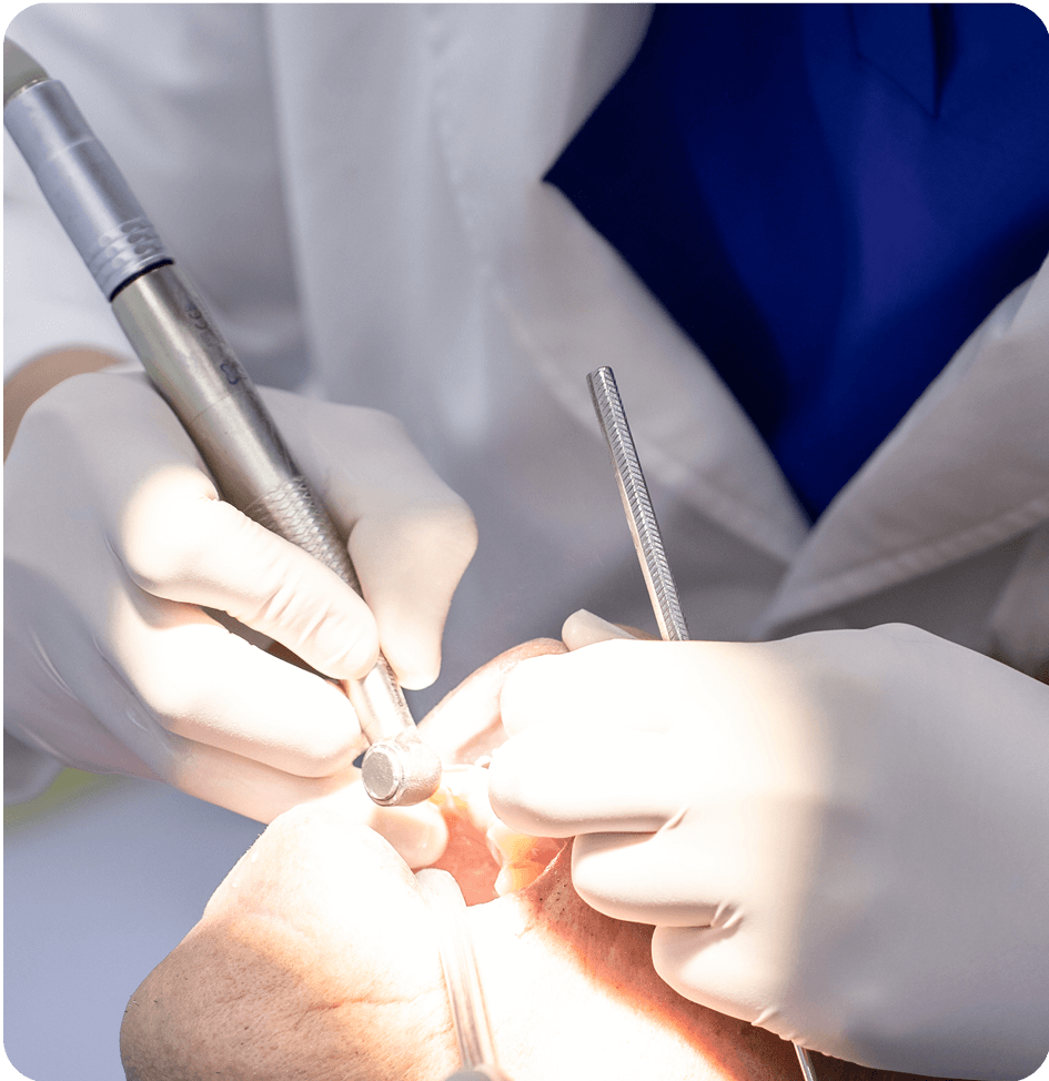 Tiến hành mài và lấy dấu răng bằng công nghệ Scan 3D