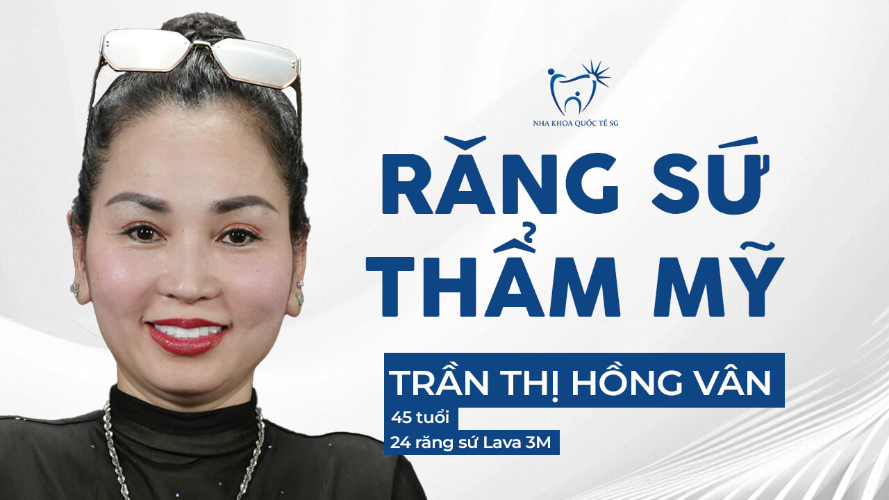 chị vân làm răng sứ thẩm mỹ