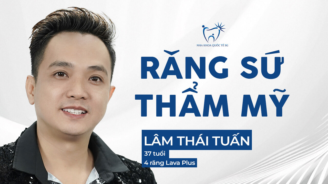 anh lâm thái tuấn làm răng sứ thẩm mỹ