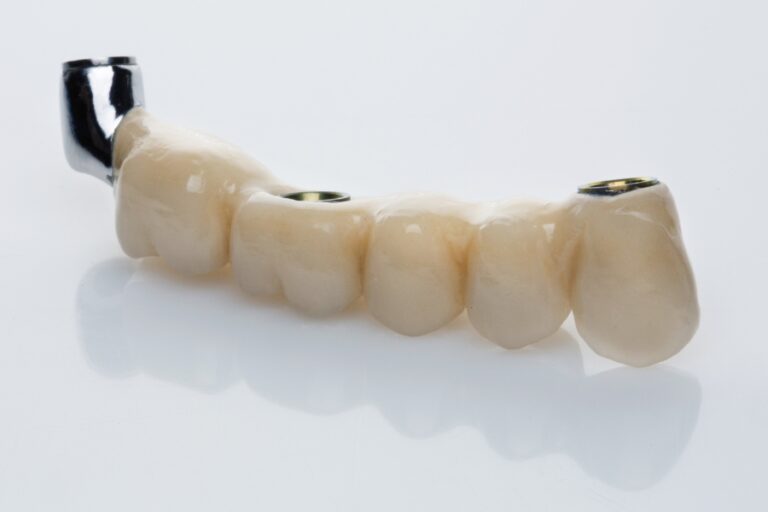 Nha Khoa Quốc Tế Sài Gòn Mô hình răng sứ thực tế tại nha khoa