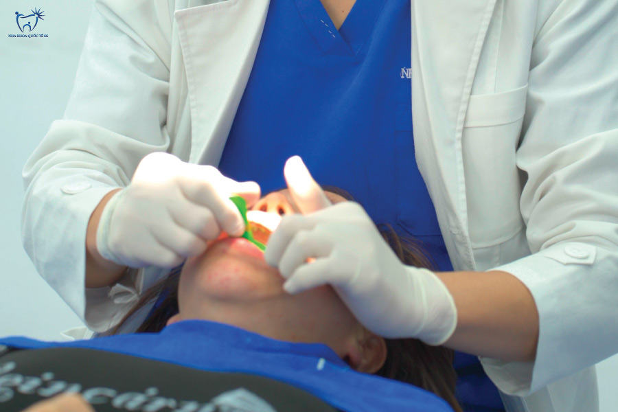 Bác sĩ thực hiện lấy dấu hàm để làm răng sứ Titan
