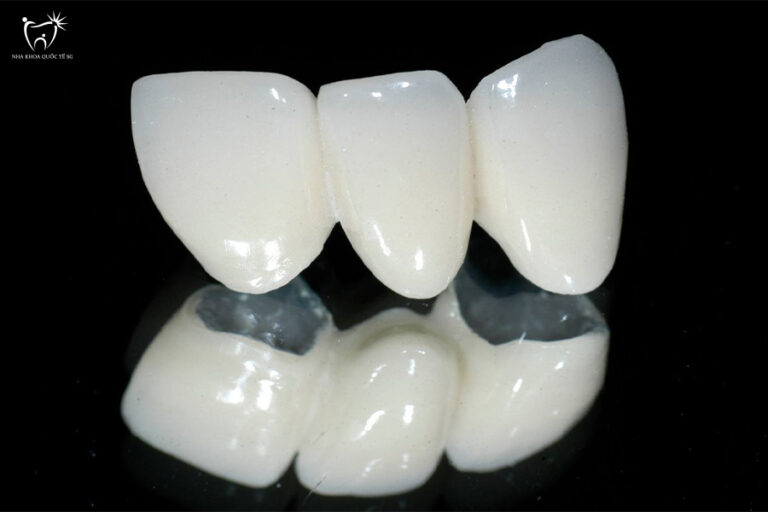 Nha Khoa Quốc Tế Sài Gòn Răng sứ Titan có phải lựa chọn tốt không?