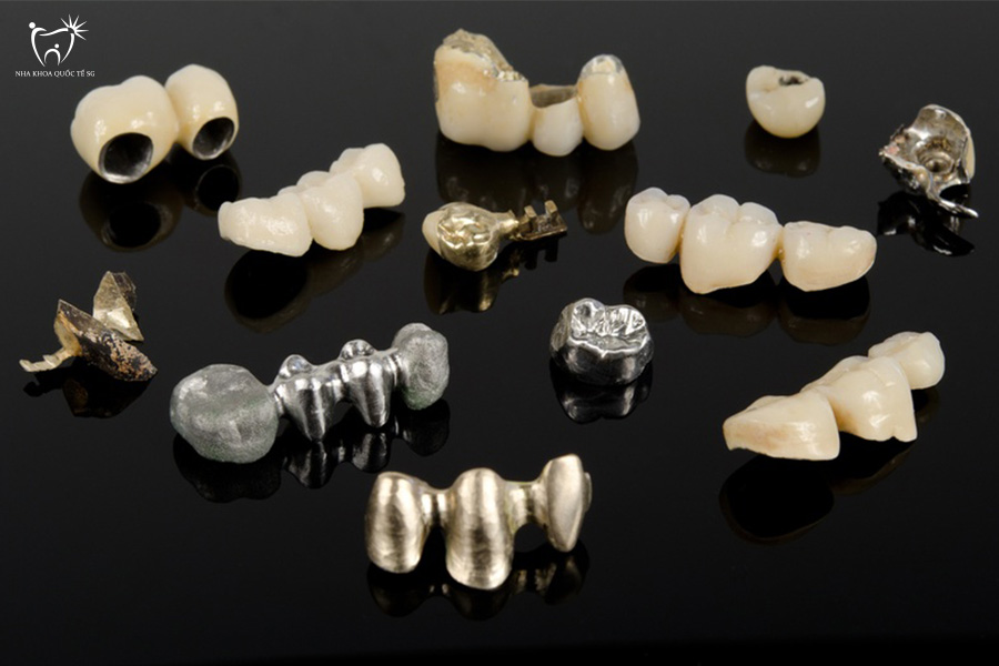 Nha Khoa Quốc Tế Sài Gòn Mô hình các loại răng sứ Titan khác nhau