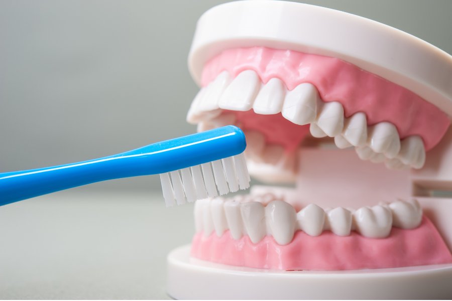 Chăm sóc răng sứ Titan đúng cách giúp răng chắc khỏe
