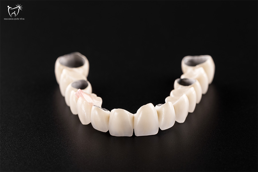 Nha Khoa Quốc Tế Sài Gòn Mỗi loại răng sứ Titan đều có ưu và nhược điểm riêng
