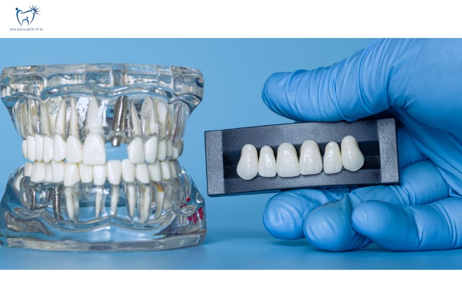 Mô hình hàm răng giả lập trong suốt cùng mão răng sứ Zirconia