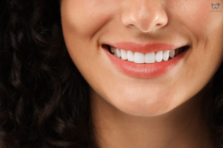 Chọn loại Veneer phù hợp giúp bạn có nụ cười rạng rỡ