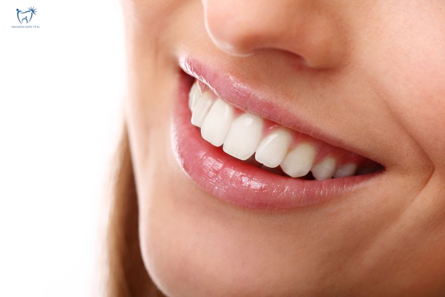 Nụ cười tự tin sau khi bọc răng sứ thẩm mỹ