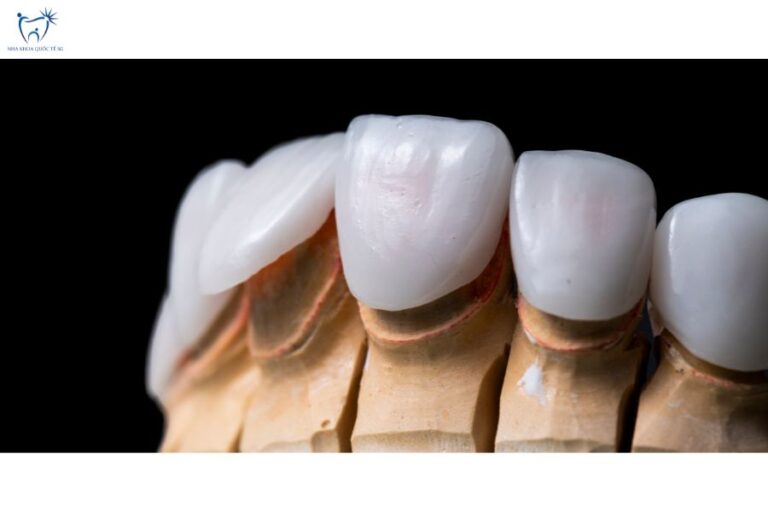 Mô hình mô phỏng thực tế dán sứ Veneer