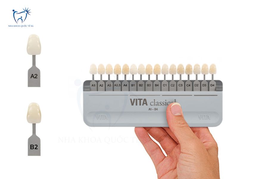 Bảng màu VITA Classic với các mã màu trắng sữa A2 và B2