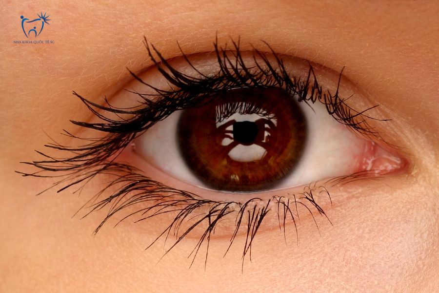 Màu của lòng trắng mắt là thước đo tiêu chuẩn để bác sĩ