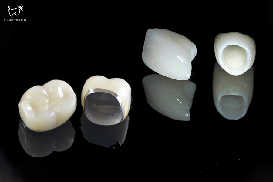 So sánh cấu tạo bên trong của răng sứ kim loại và răng toàn sứ 