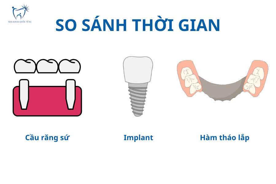 Thời gian thực hiện cầu răng sứ so với các phương pháp khác