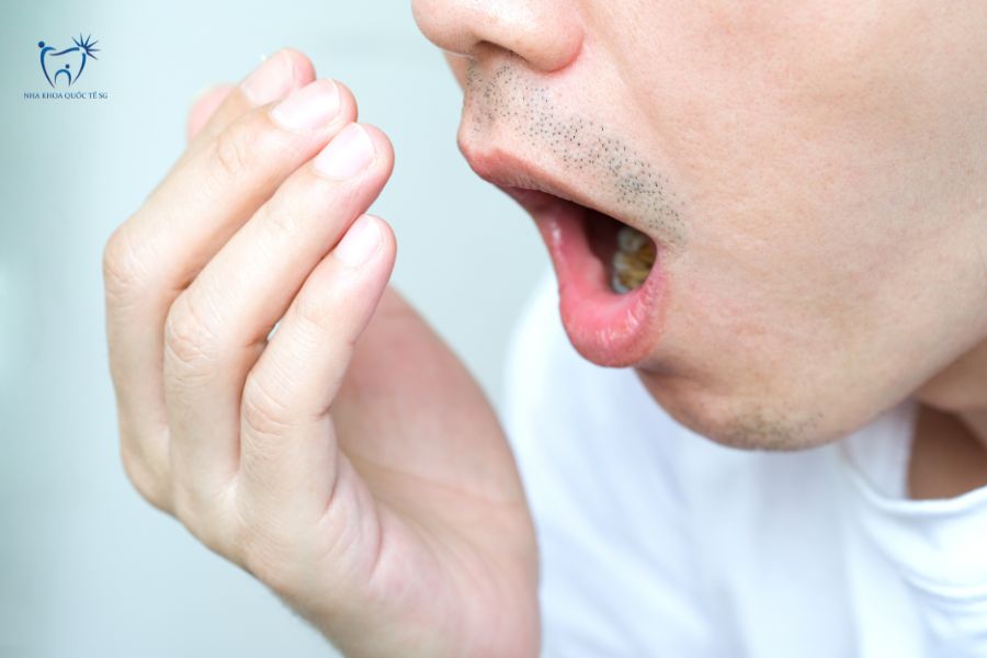 Thức ăn kẹt trong miệng dẫn đến hôi miệng