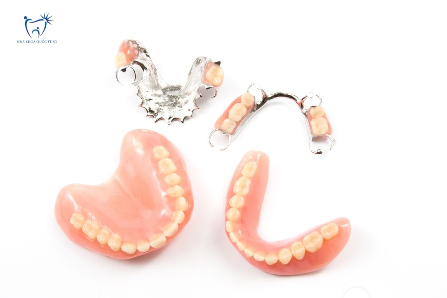 Các loại hàm giả tháo lắp