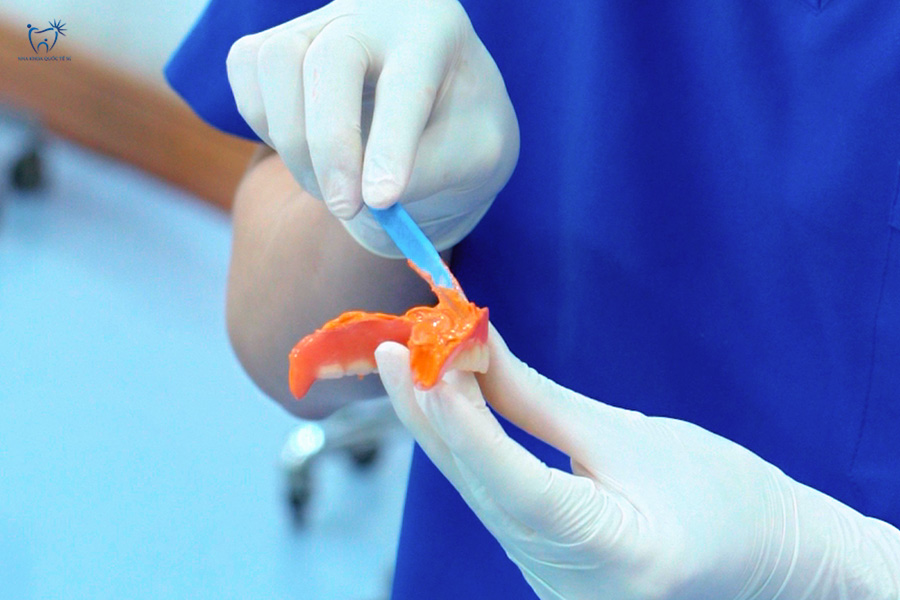 Bác sĩ lấy dấu răng của bệnh nhân