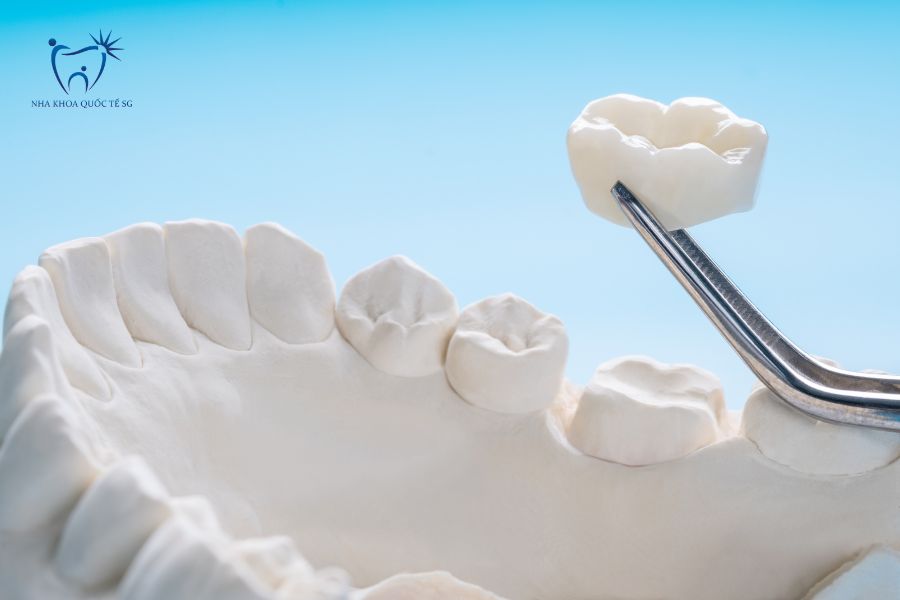 Răng sứ và mô hình hàm răng mô phỏng