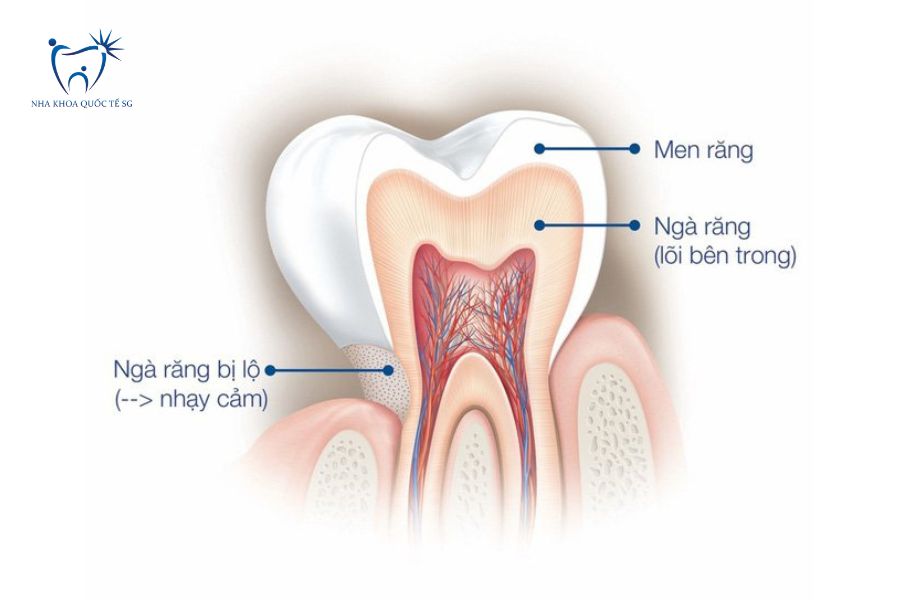 Mô hình mô tả cấu tạo của răng