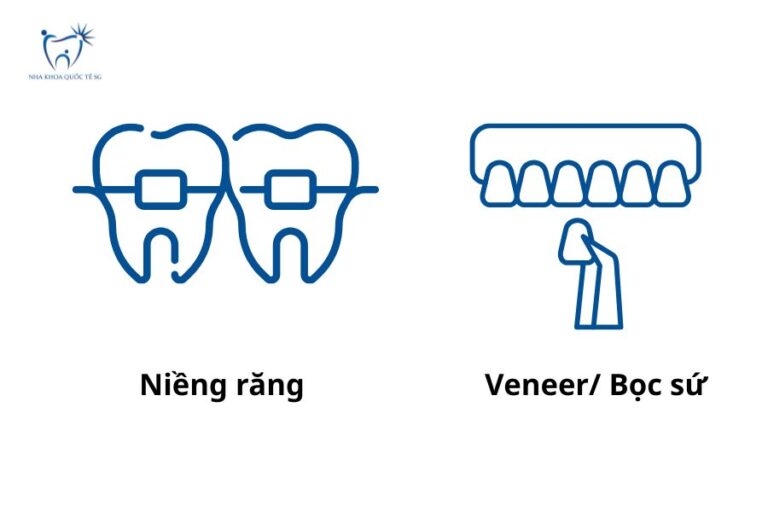 So sánh giữa niềng răng và bọc răng sứ