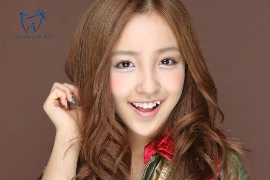 Người mẫu có răng khểnh giúp nụ cười duyên dáng hơn